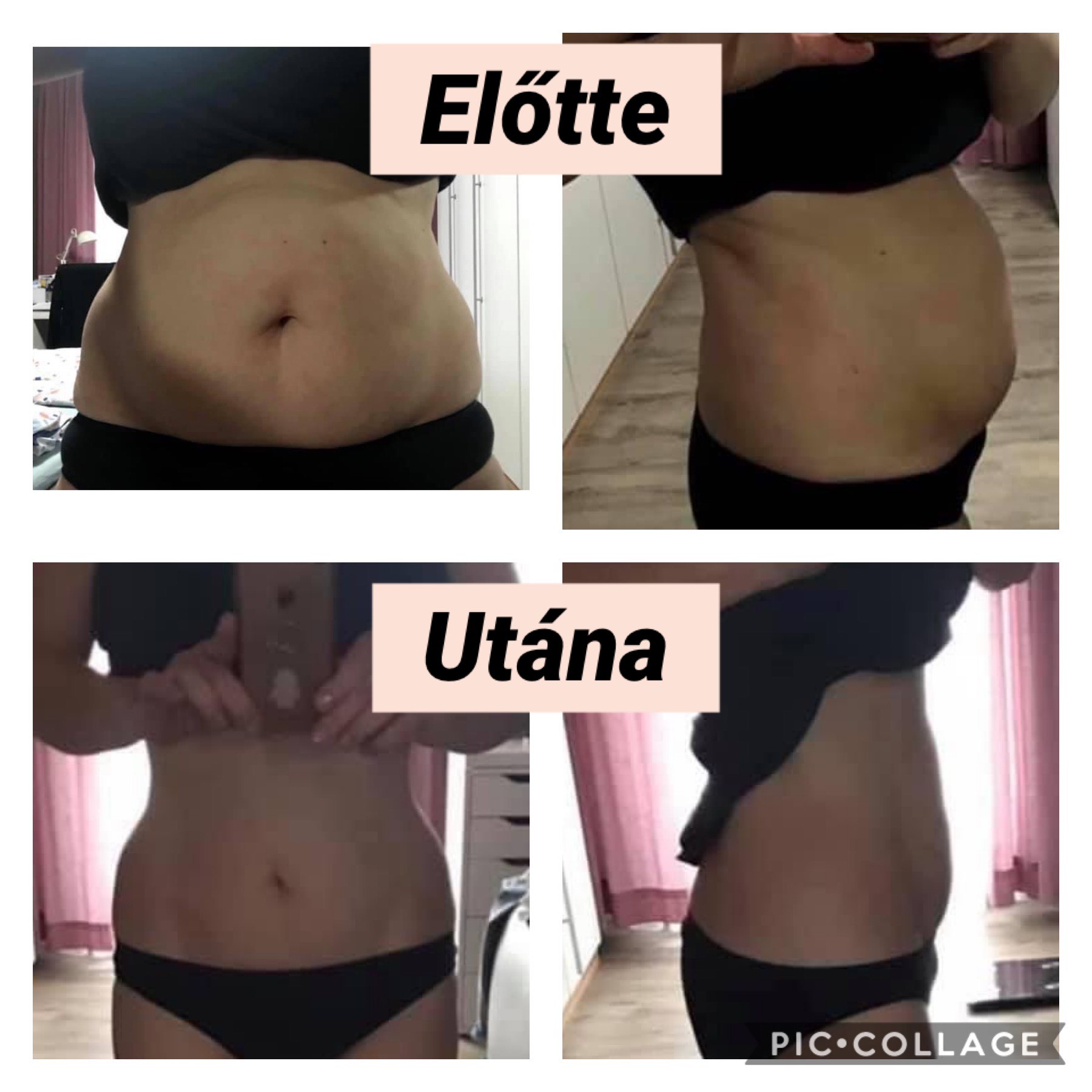 Valódi eredmény – has előtte/utána